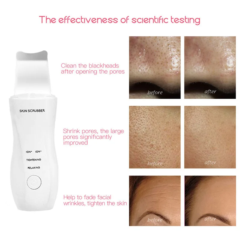  Skin Scrubber Ultrasonic Skin Scrubber Cleanser Face Cleaning Acne Face Lifting Massager Beauty Dev