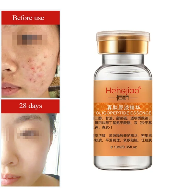 

Pure Natural EGF Serum Shrinking Pores Remover Scars Pimple Marks Skin Repairing Essential Liquid Easy To Absorb