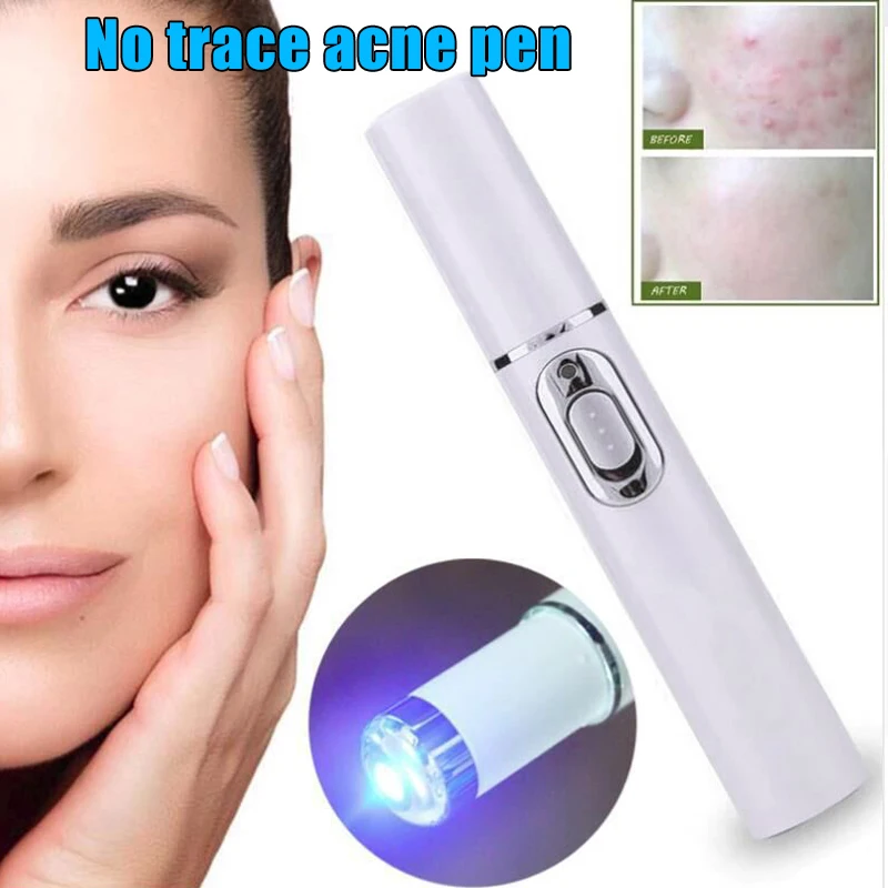 

Portable Blue Light Remove Acne Pen Wrinkle Removal Skin Care Tool EY669