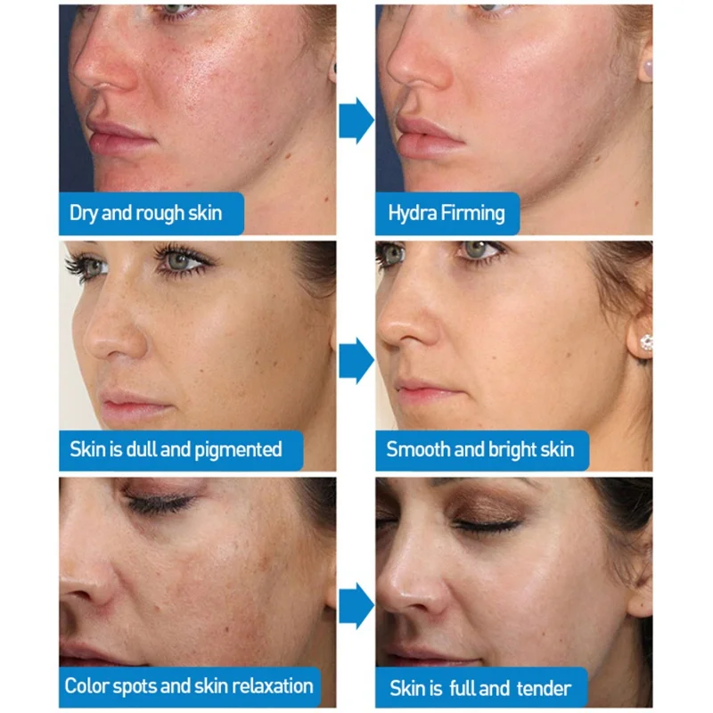 Small Molecule Hyaluronic Acid Ampoule Serum Hydrating Firming Skin Anti-wrinkles Face Serum