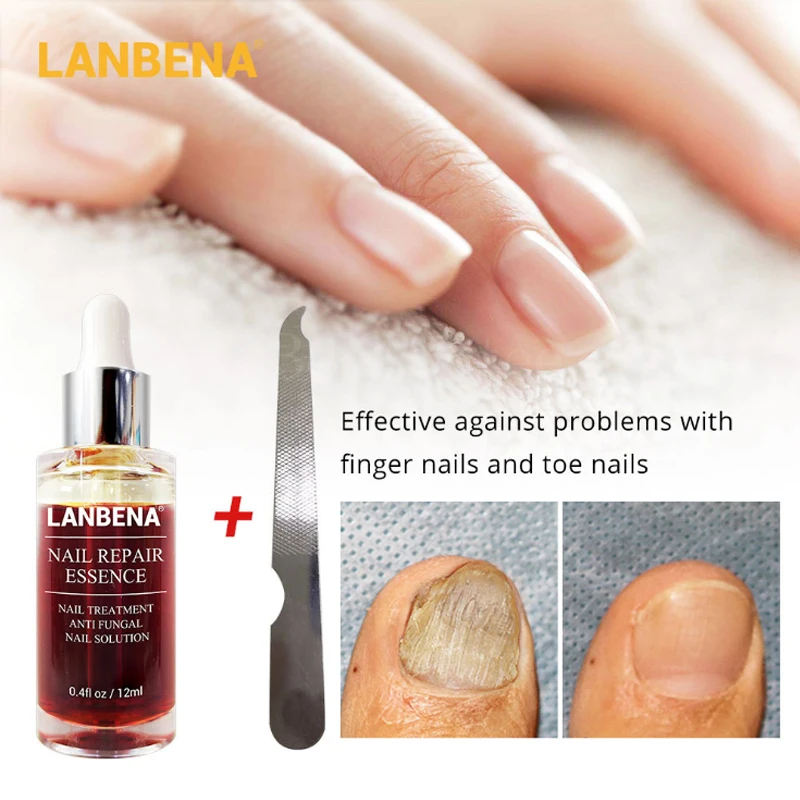 Эссенция Lanbena для восстановления ногтей средство от грибка лечение Lambena Antihongos на
