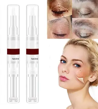 

Dropship Wipeoff Tags & Moles Remover Liquid Wart Removal Pen Genital Wart Treatment 3ml