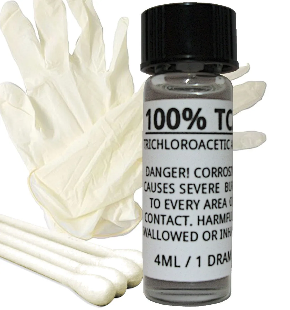 

100% TCA Skin Peel Kit Removes Skin Tags, Age Spots, White Spots, Stretch Marks