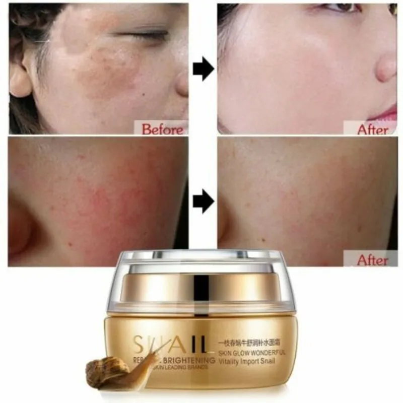 

OneSpring Moisturizer Snail Face Cream Whitening Acne Treatment Anti Aging Repair Facial Skin Care Cream Beauty Glow Day Night