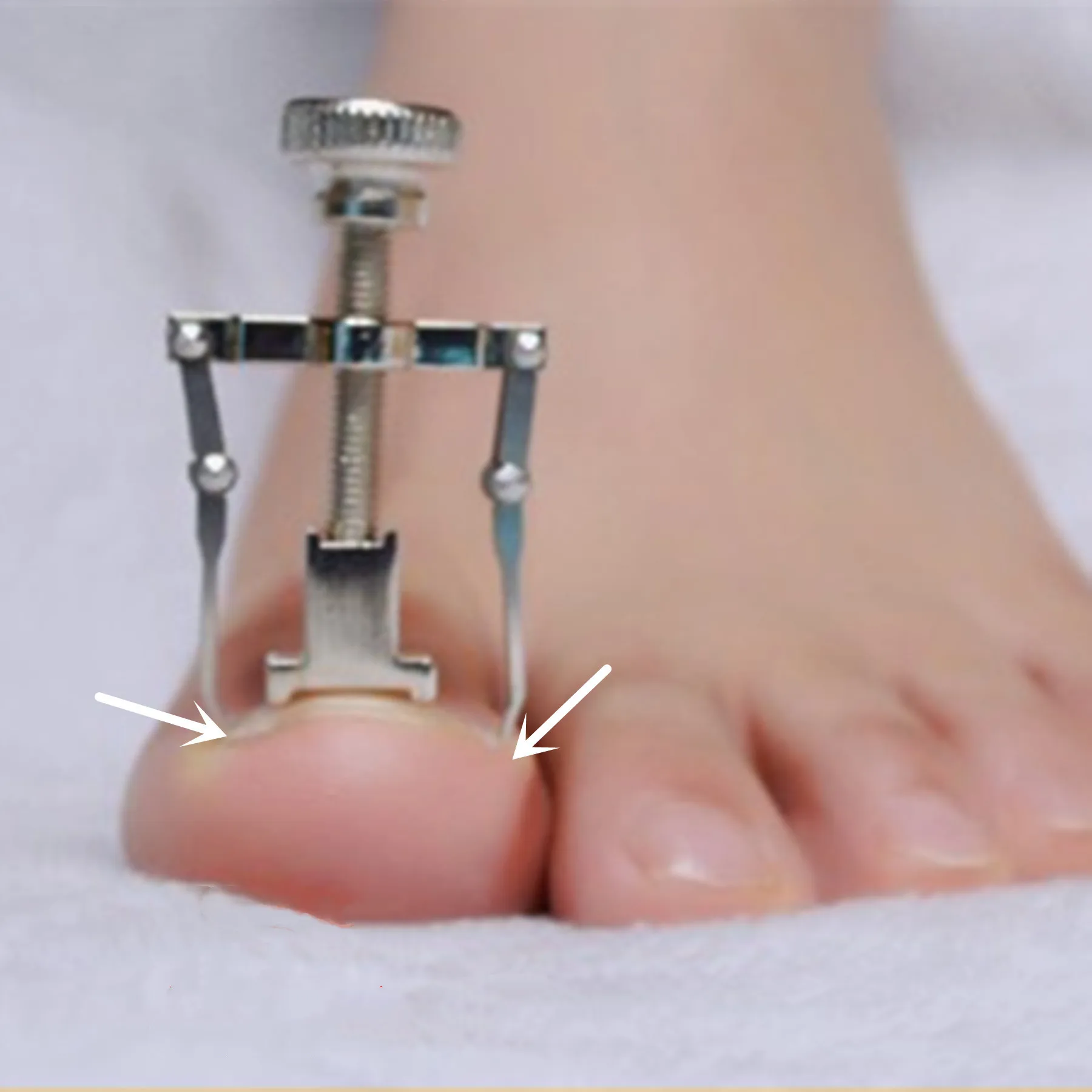 

Silver Ingrown Toe Nail Fixer Pedicure Recover Embed Toenail Correction Lifter Tool Set LJ18