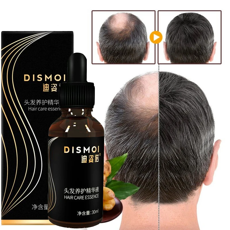 Hair Care Hair Growth Products Fast Growing Hair Oil Hair Loss Care Liquid Beauty Hair & Scalp Treatment Dense Hair Growth Serum