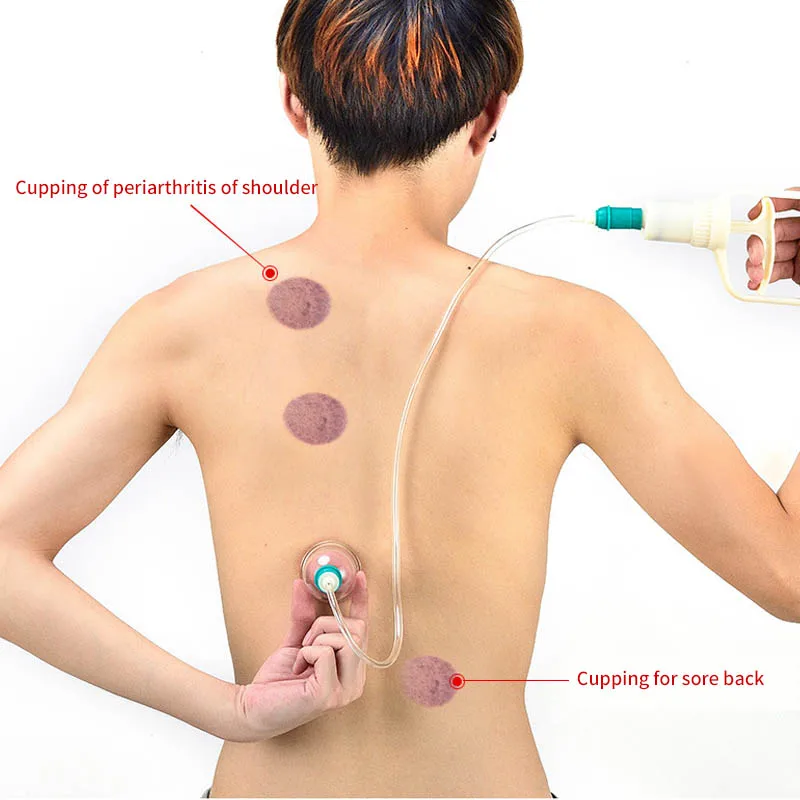 Chinese Cupping Therapy Set Medicine Physiotherapy Vacuum Massage anti cellulite ventosa Suction Cups Body Massager fat burner 2
