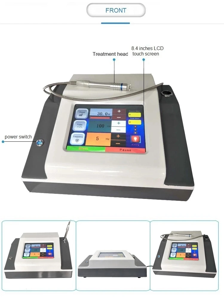 Портативная 980nm Диодная лазерная машина для лечения сосудов/красные кровеносные сосуды удаление спайдерной вены 980 нм