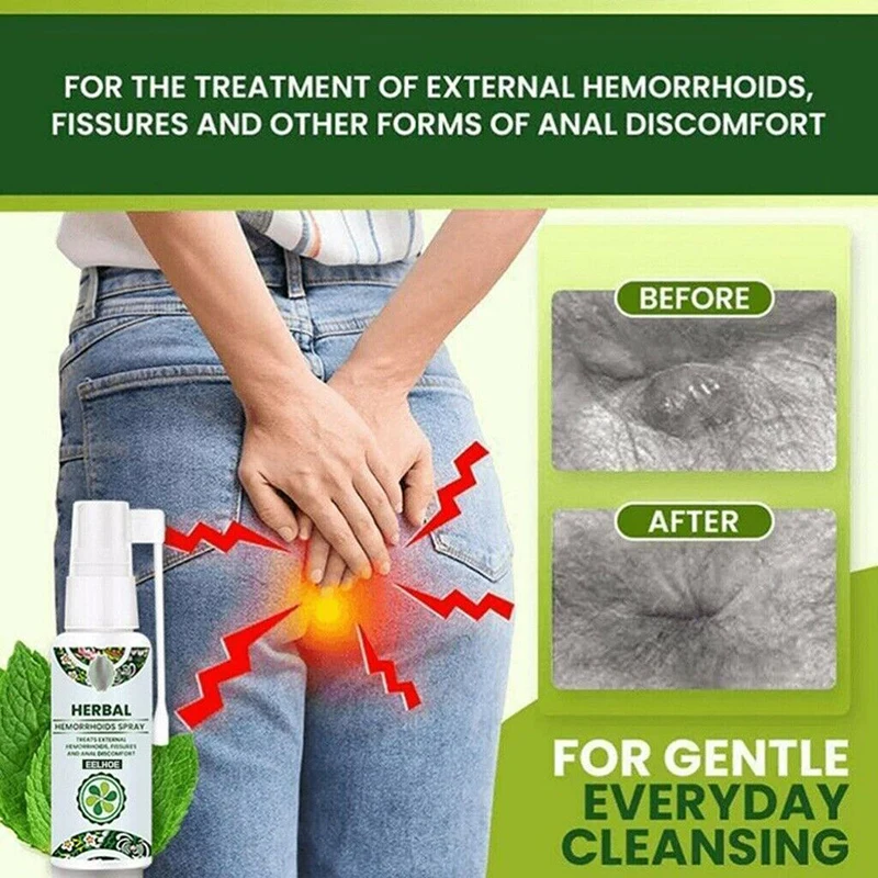 30ml Natural Herbal Hemorrhoids Spray Powerful Hemorrhoids Treatment Agent Relieve Anal Pain Spray