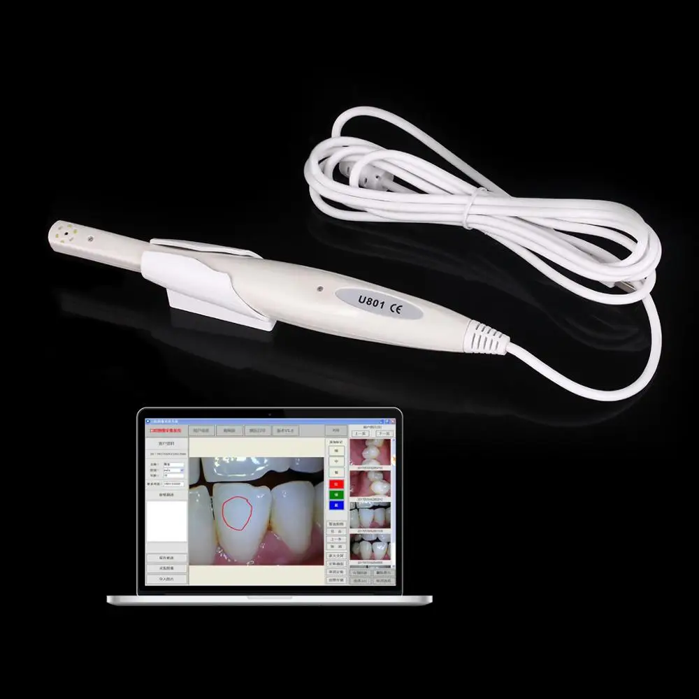 Dental Camera HD Intraoral Endoscope With 6 Led lights Inspection for Dentist Oral Real-time Video 