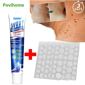 

Wart Removal Body Warts Treatment Cream Skin Tag Remover Foot Corn Removal Plantar Wart Ointment Skin Tag Remover Acne Stickers