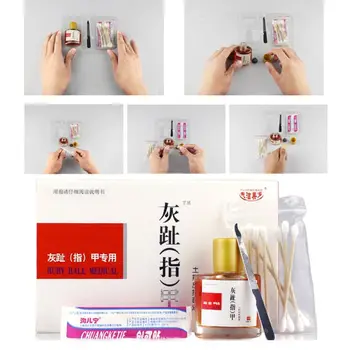 

25ml Nail Fungal Treatment Set Chinese Herbal Medicine Toenail Anti Fungus Infection Repair Essence Liquid Onychomycosis Removal