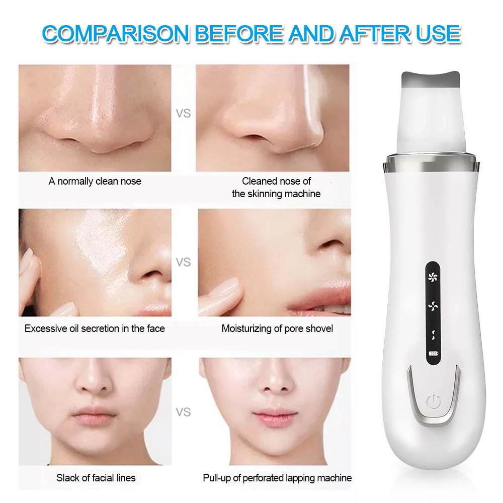 Facial Skin Scrubber Blackhead Remover Ultrasonic Face Deep Pore Acne Cleaner Spatula Face Lifting Whitening Massager Skin Care