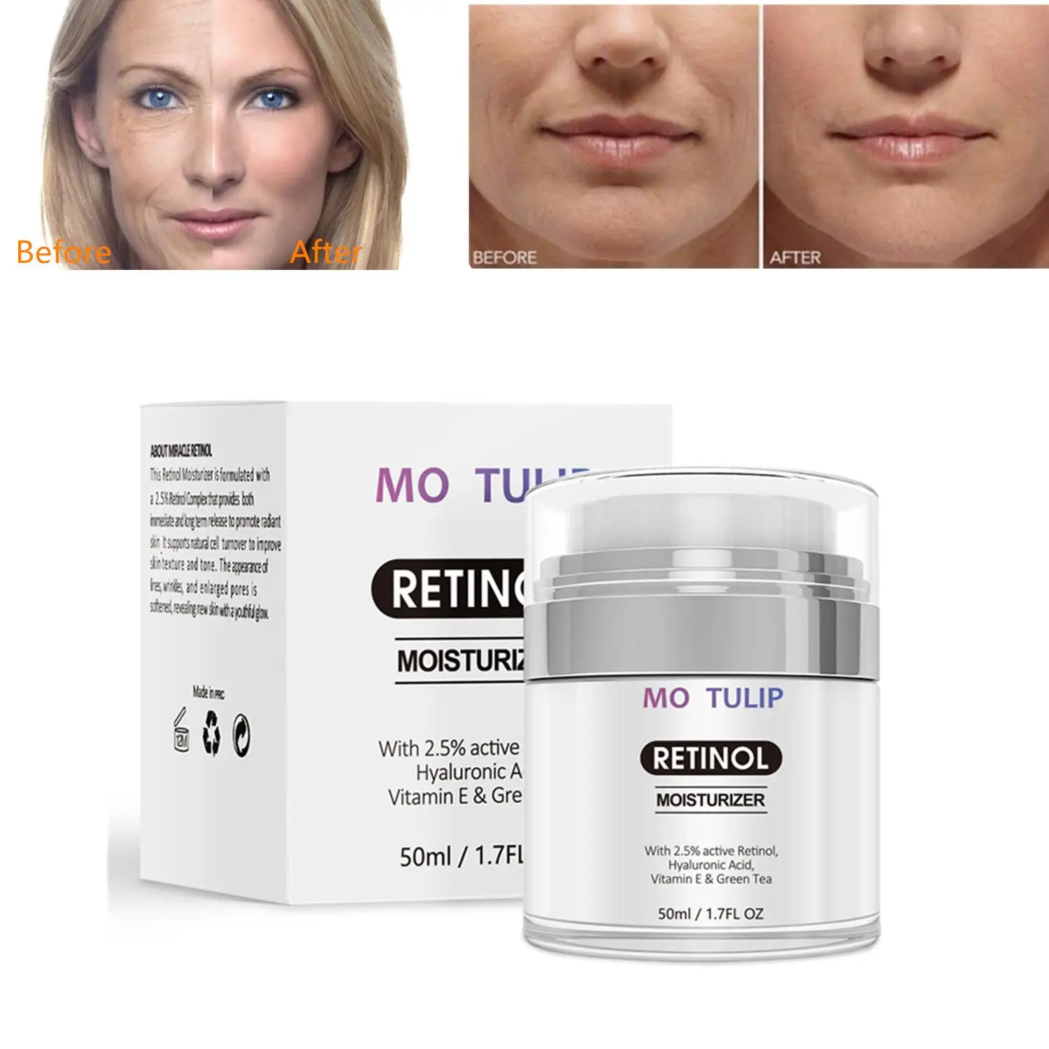 MO в форме тюльпана от 50 мл Retinol 2.5% увлажняющий крем против старения и уменьшает