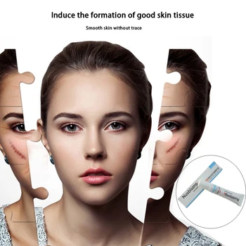 

3pcs Nuobisong lanbena face anti care acne treatment cream scar removal oily skin Acne Spots skin care face stretch marks