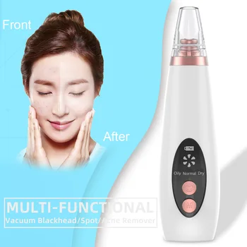 

Mini Facial Cleansing Brush Exfoliator Face Wrinkles Reducing Suction Firming Pimple Vacuum Cleaner Portable Blackhead Remover