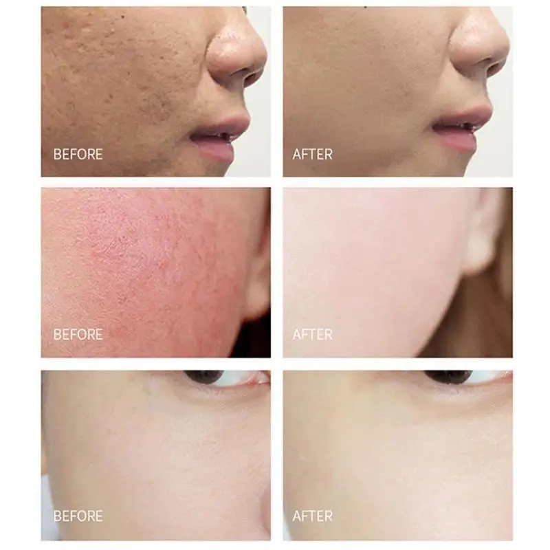 Copper Peptide face serum Freeze-Dried Power shrink pores serum Skin Care serum 6pcs Acne Treatment pore minimizer