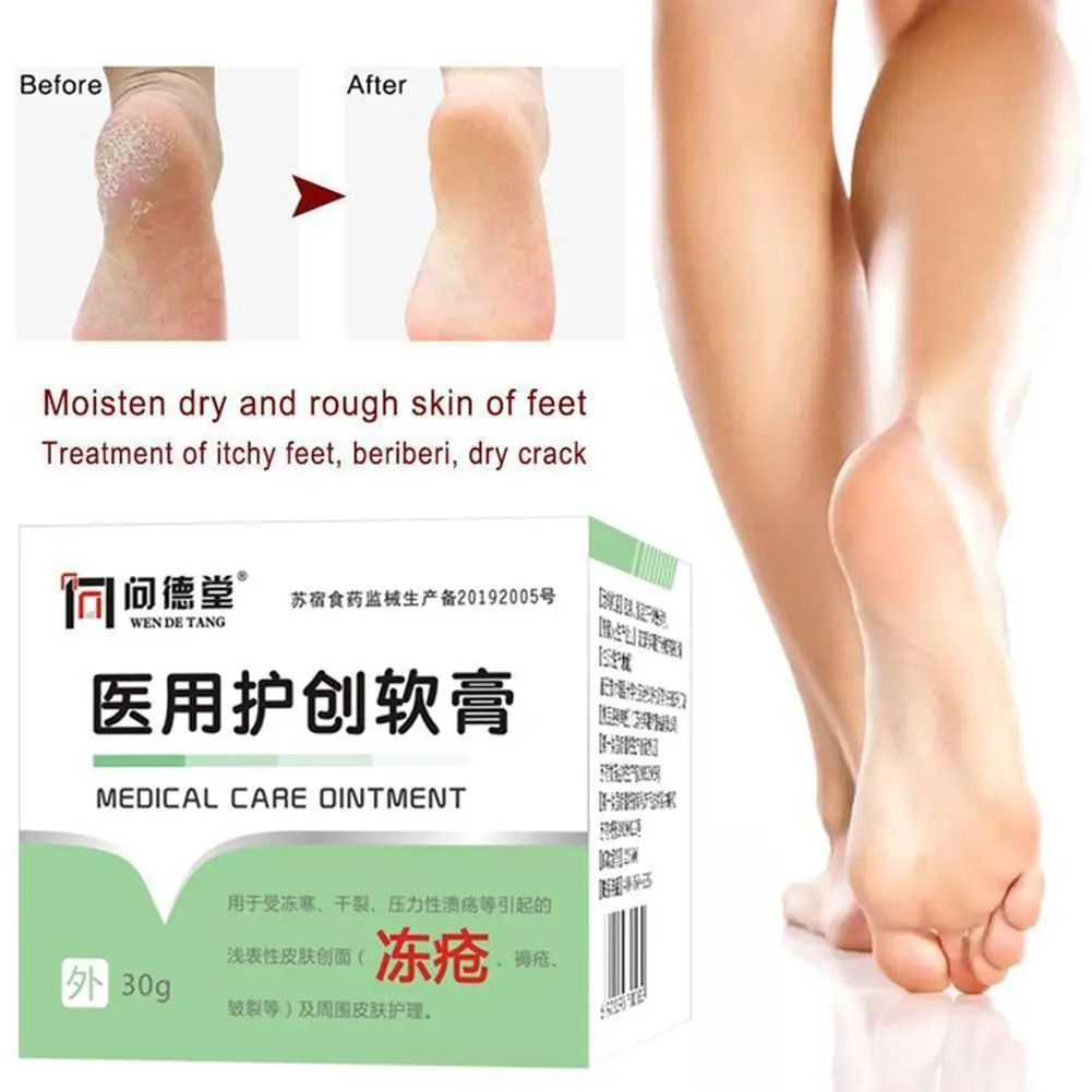 

Anti Dry Crack Powerful Frozen Cracking Cream Prevent Chapped Dry Repair Frozen Chinese Skin Medicinal Frostbite Ointment Y9R1