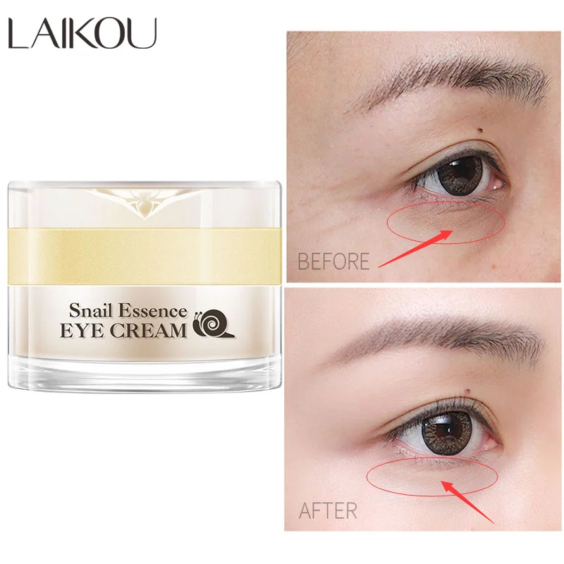 Snail Anti Aging Eye Cream Essence Deep Hydrating Against PuffinessFade Fine Lines Dark Circle Eye Bags Nourishing Eye Skin Care