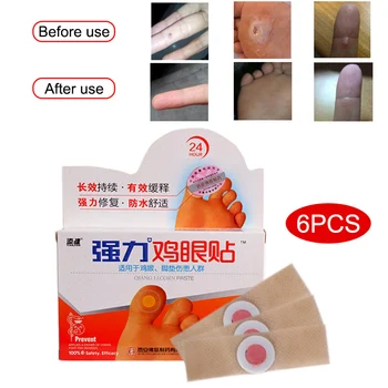 

6 Pcs Medical Calluses Plantar Warts Thorn Plaster Removal Pain Relief Patch Feet Corn Removal SSwell