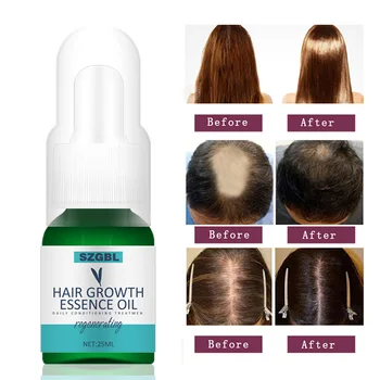 

Hair Growth Essence Hair Loss Dense Hair Fast Hair Growth Oil Grow Restoration Growing Serum 25ml