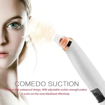 

Electric Blackhead Remover Vacuum with HEAT Deep Pore Dermabrasion Face Cleaner