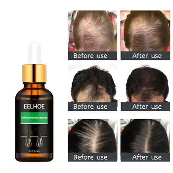 

Blue ZOO 30ml Hair Care Essence Oil Hair Growth Essence Hair Repair Treatment Liquid Regrowth Essential Oil Serum