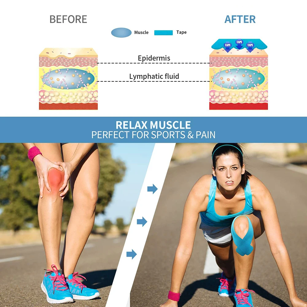 SKDK Elastic Kinesiology Tapes Athletic Recovery Kneepad Sports Safety Muscle Pain Relief Knee Pads Support Gym Fitness Bandage