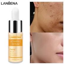 Skin-Essence-Fade Face-Serum Lighten Remove-Freckle Spots Whitening Speckle-Care Vitamin-C