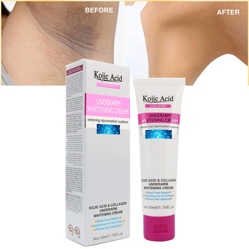 50 мл Kojic кислота для женщин Отбеливание подмышки крем подмышек частная часть
