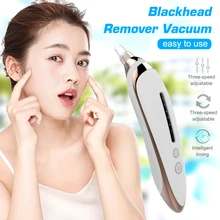 Вакуумное средство для удаления угрей, 3 уровня всасывания, электрическое очищающее средство для пор, черная точка, акне, черная головка, экстрактор прыщей, присоска, инструмент для красоты