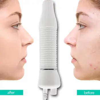 

5 in 1 Ultrasonic Face Massage Machine High Frequency Electronic Beauty Instrument Face Skin Care Tools EU Plug