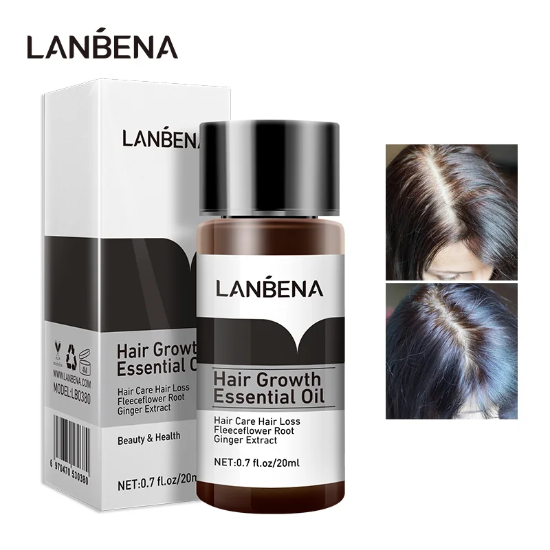 LANBENA Ginger Fast Powerful эфирное масло для роста волос продукты лечения и предотвращения