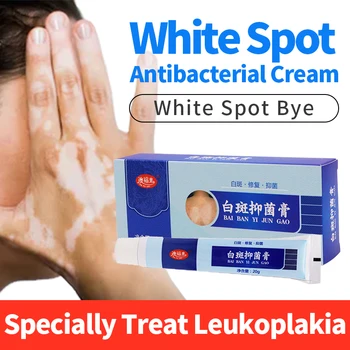 

20g Chinese Medical White Spot Antibacterial Cream Promoting Skin Vitiligo Leukoplakia Disease Pigment MelaninTreatment