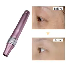 Микро Ручка с иглой для стимуляции подтяжки кожи удаление шрамов уменьшение морщин кожи устройство для Удаления растяжек шрамов