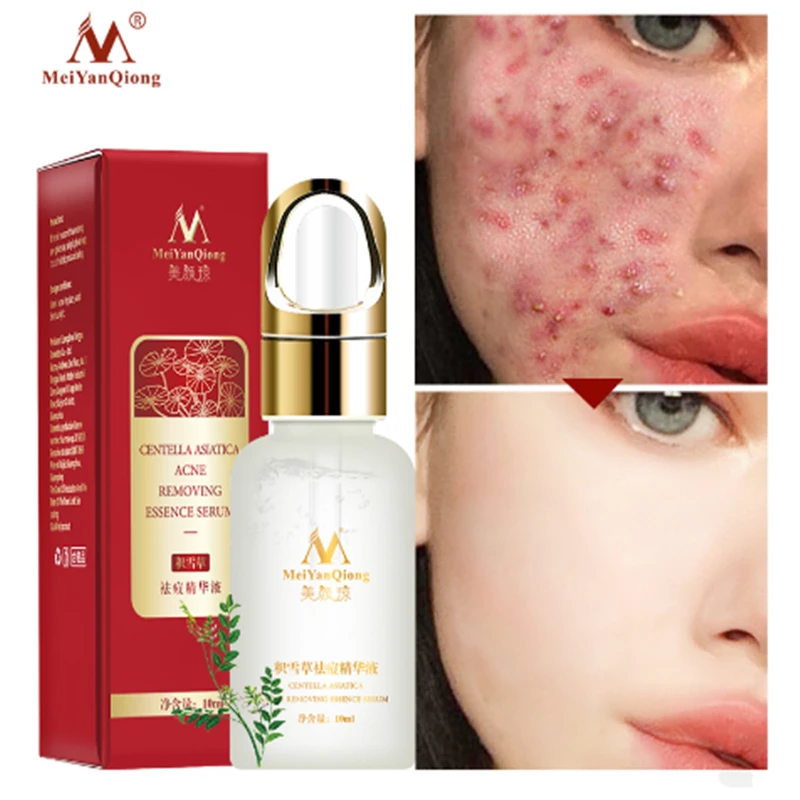 Центелла азиатской элиты эссенции sеrum visage Liquid hydratant анти-аттракцион ratizement huile de contróle des p
