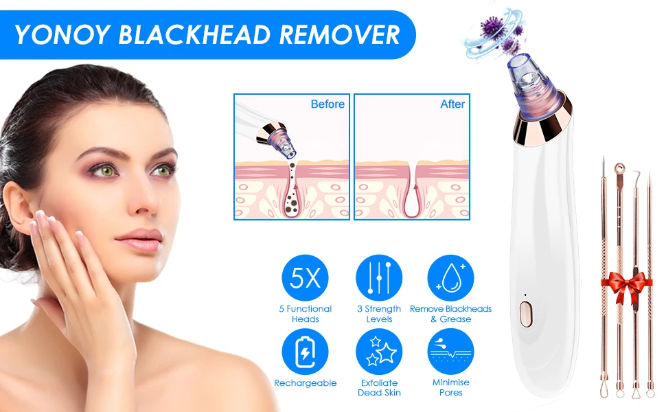Blackhead Remover Pore Vacuum 1