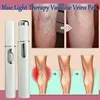 Blue Light Therapy Varicose Vein Pen Medical Varicose Scar Vein Pen Light Blue Acne Therapy Treatment P0R3 4