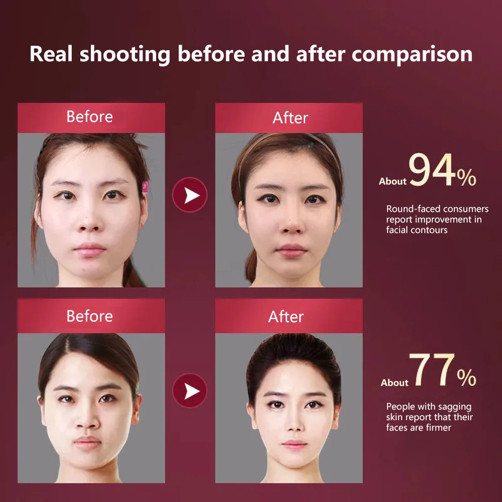 Mikroprądowy V Face Shape Face Lifting EMS Masażer wyszczuplający do twarzy Usuwanie podwójnego podbródka Terapia światłem LED Urządzenie do liftingu twarzy_voghion.com