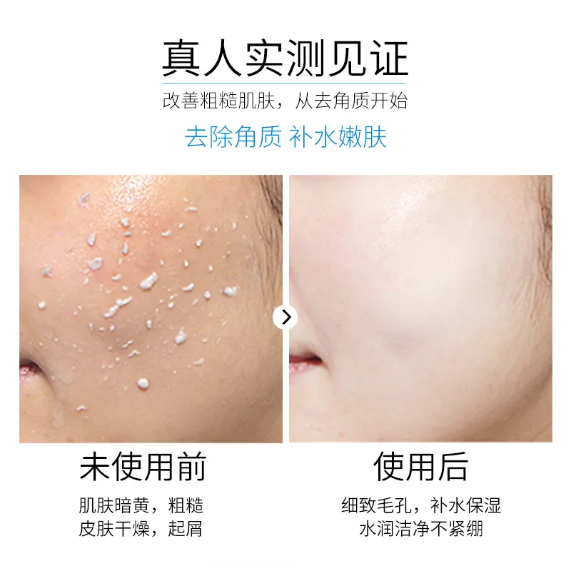Beauty Brand Отшелушивающий Отбеливающий Гель для Кожи увлажняющий крем Сужающий поры