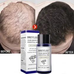 BREYLEE Hair Fast Growth Essential Oil Hair & Scalp Treatments Prevent Hair Loss Thinning Repair Beauty Hair Serum Products 20ml