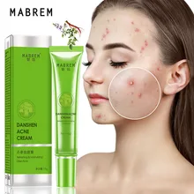 Effective Acne Removal Cream Acne Treatment Fade Acne Spots Oil Control Shrink Pores Whitening Moisturizing Acne Cream Skin Care