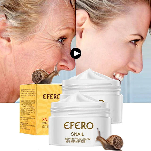 Hyaluronic Acid Face Cream Moisturizer Snail Cream Whitening Cream Acne Removal Freckle Cream Anti Wrinkle Anti Aging Eye Cream 5