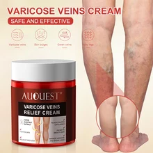 

Varicose Veins Cream Swollen Legs Pain Relief Spider Veins Treatment Effective Legs Pain Relief Ointment Massage Cream Soothing