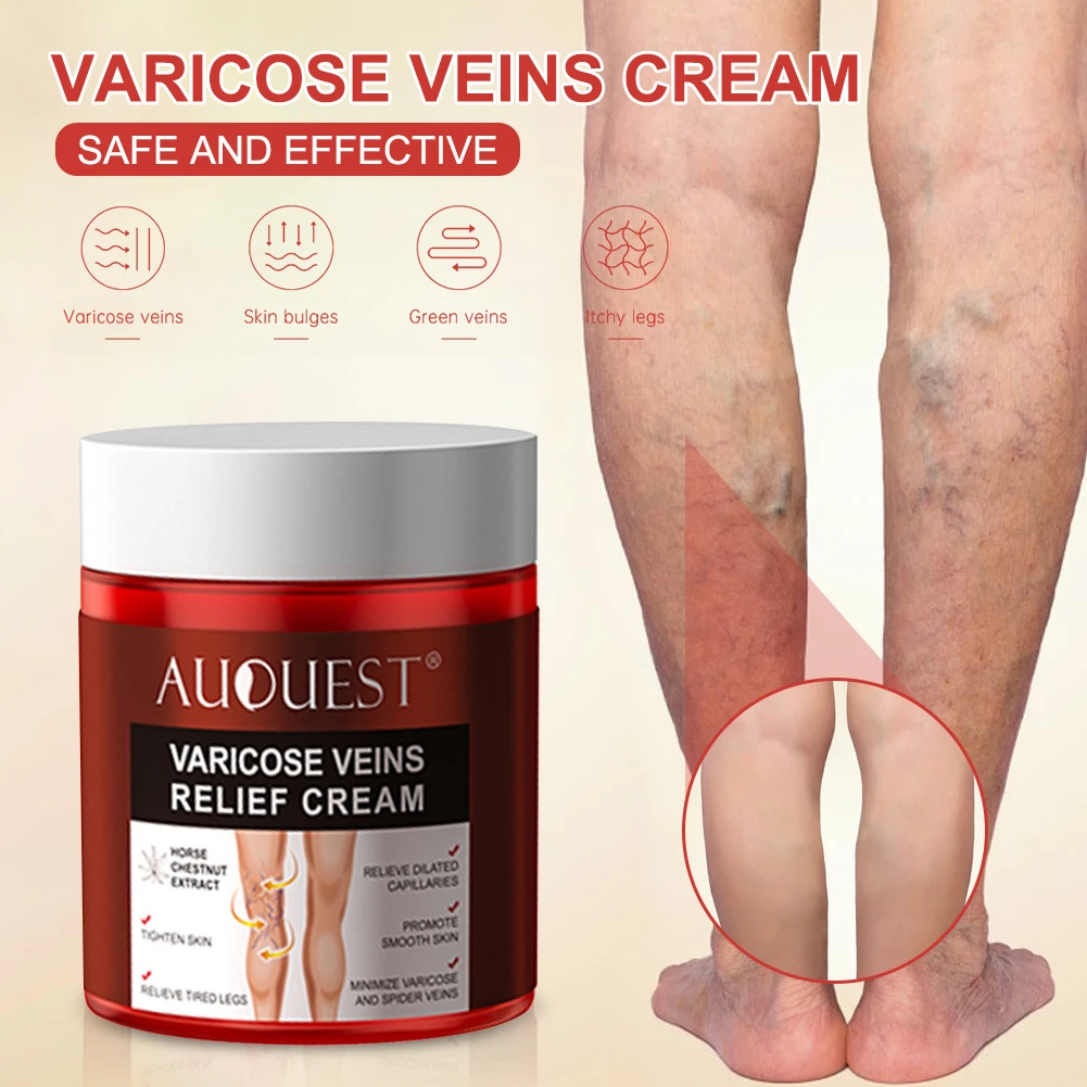 Varicose Veins Cream Swollen Legs Pain Relief Spider Veins Treatment Effective Legs Pain Relief Ointment Massage Cream Soothing