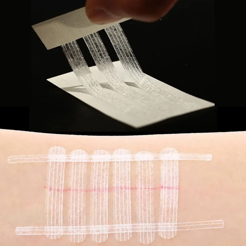 10 упаковок/партия, медицинская хирургическая клейкая лента, не нужно шовывать кожу, закрывающие полоски 12*100 мм