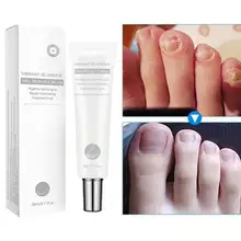 Крем для восстановления ногтей VIBRANT Glamur для удаления грибка для ногтей против грибок ногтей для ухода за ногтями 20 г