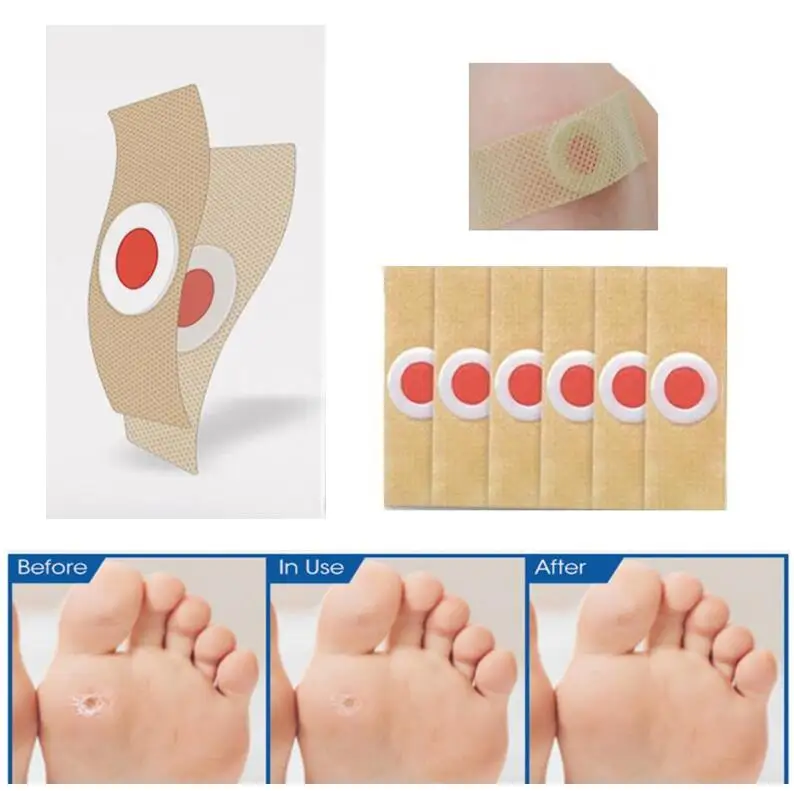 30Pcs Foot Care Sticker Medical Patch Corn Removal Pads Warts Thorn Curative Patches Calluses Remove Callosity Detox