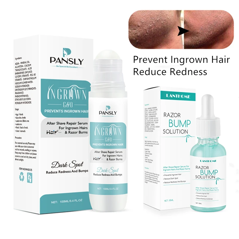 Razor Bumps Treatment ubicaciondepersonas.cdmx.gob.mx