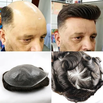 

Toupee for Men With 100% Human Hair 0.02-0.03mm Ultra Thin Skin V-looped Hair System Replacement